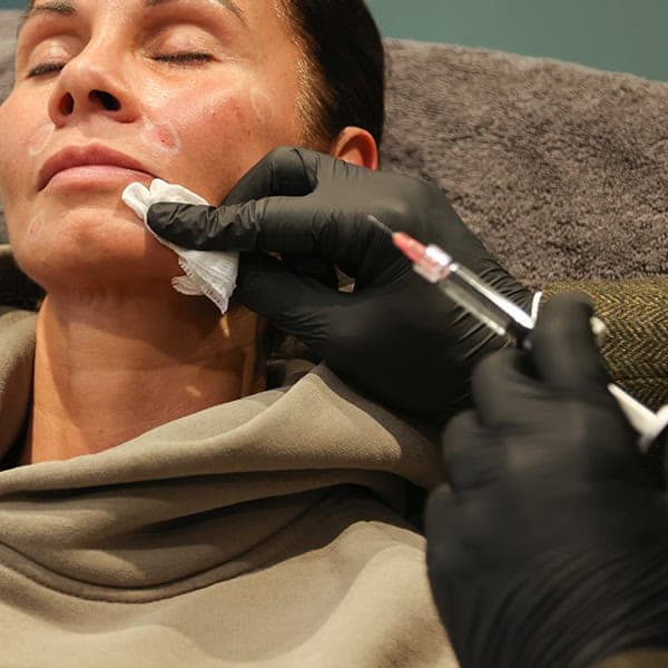 Woman receiving dermal filler injection for facial rejuvenation at Cannelle Skin Clinic.