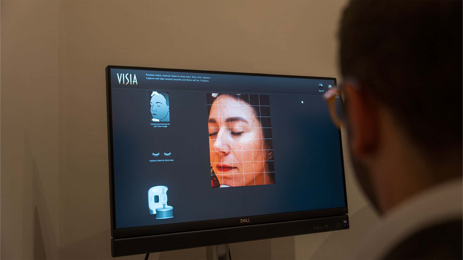 Advanced skin analysis using VISIA technology at Cannelle Skin Clinic.