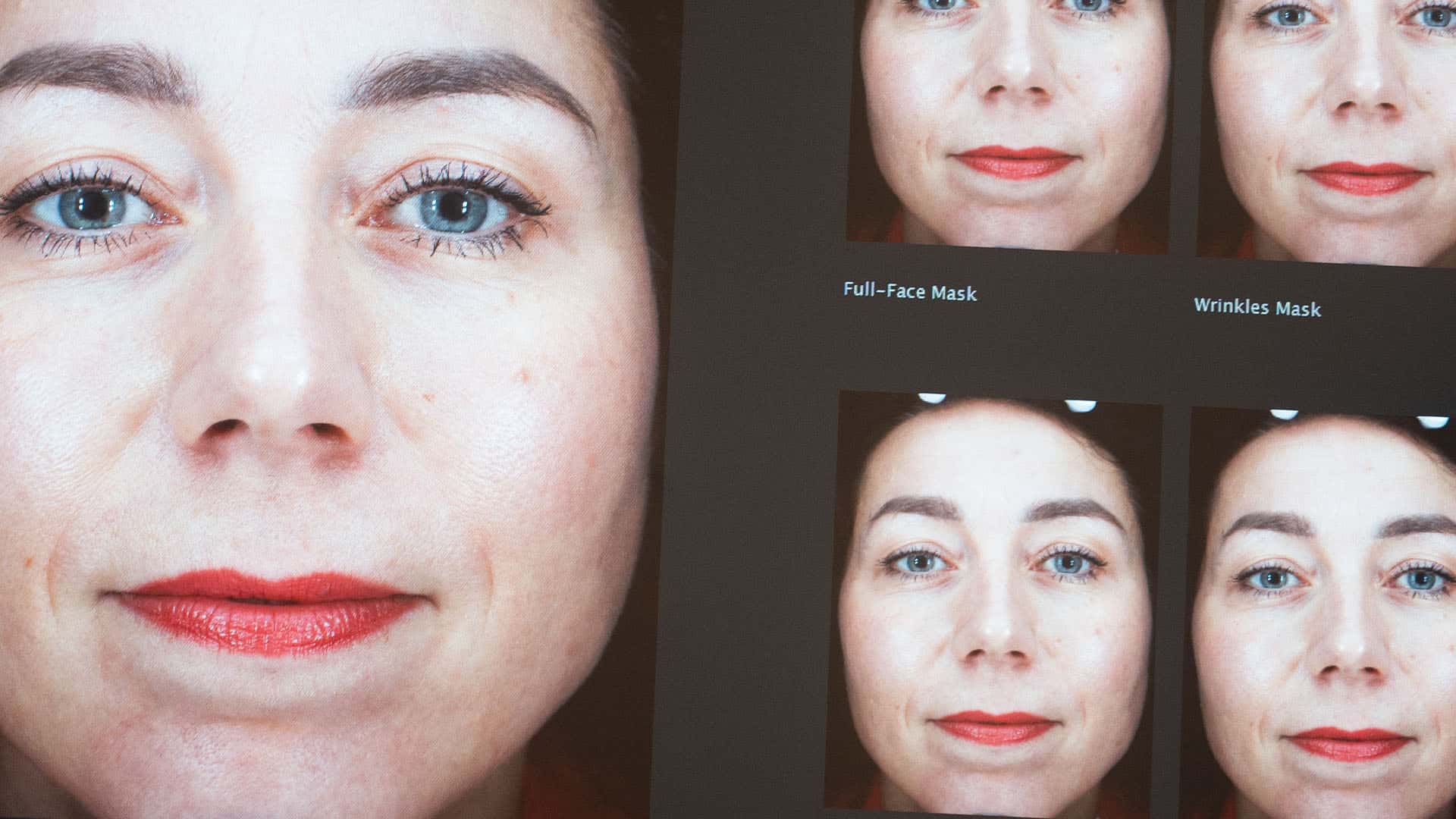Close-up of a woman’s face showing before and after skin treatments at Cannelle Skin Clinic.
