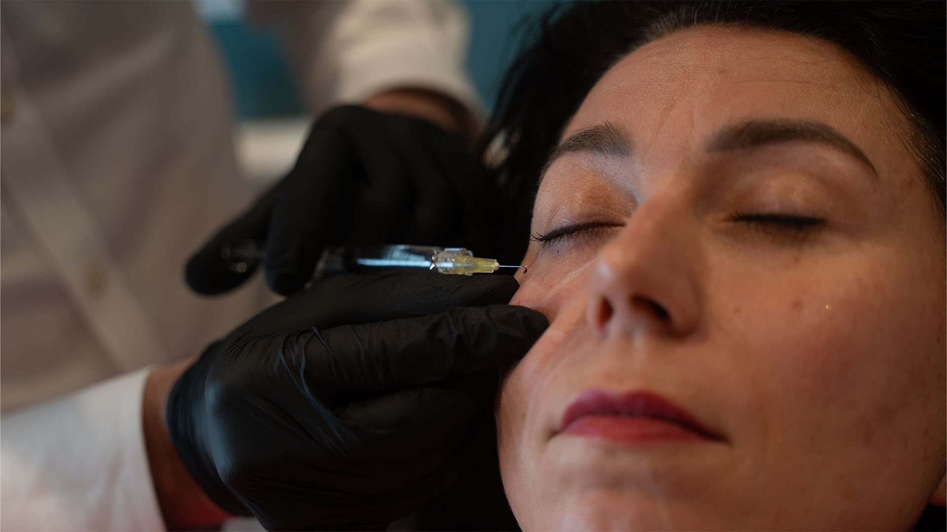 dark-circles-treatment