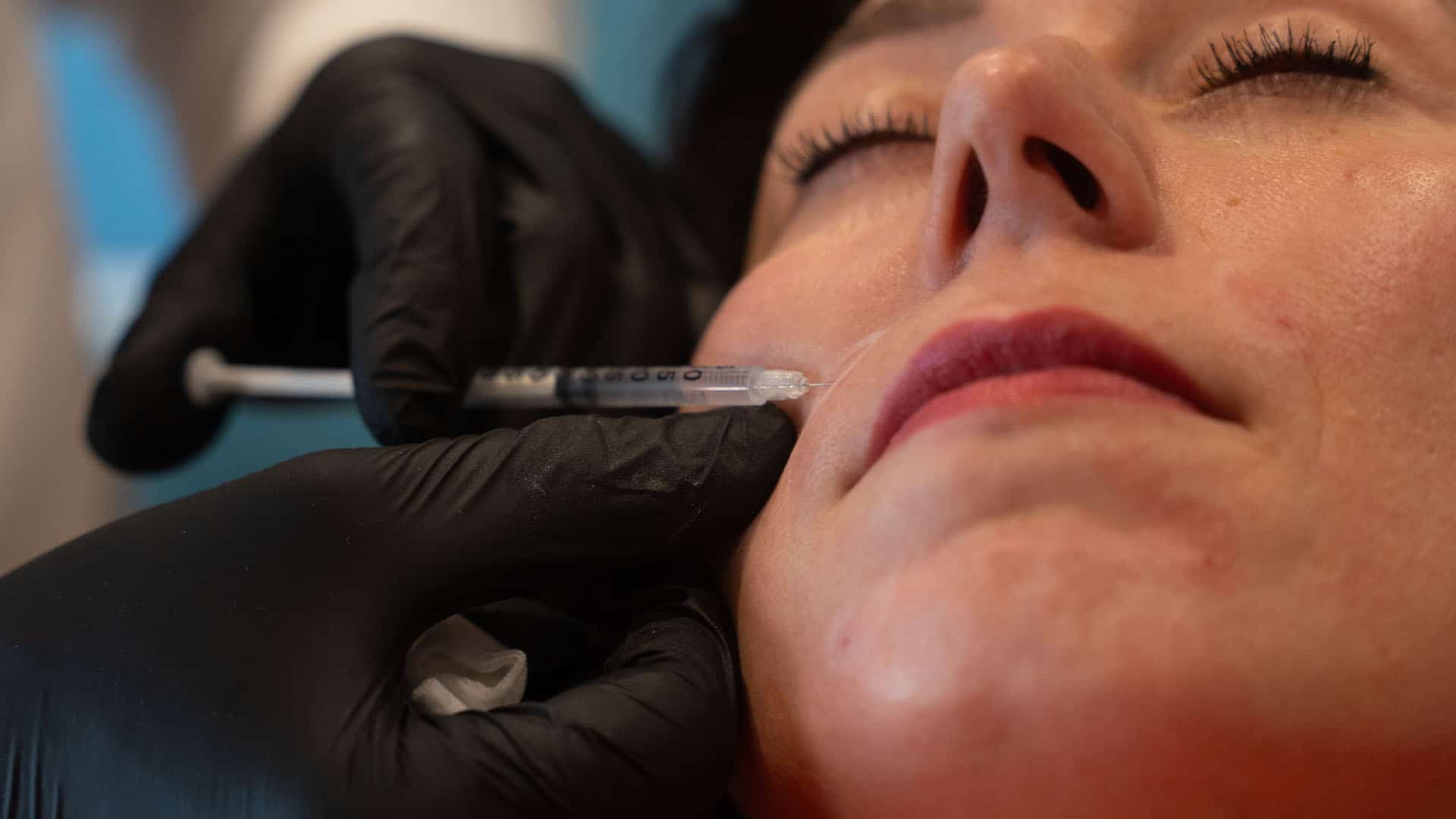 Woman receiving a facial injection for skin rejuvenation at Cannelle Skin Clinic.
