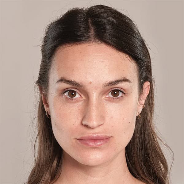 Close-up of a woman with clear, smooth skin after facial treatment at Cannelle Skin Clinic.