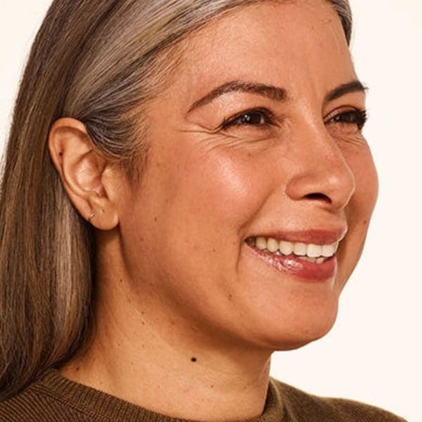Woman smiling after skin rejuvenation treatment at Cannelle Skin Clinic, London.