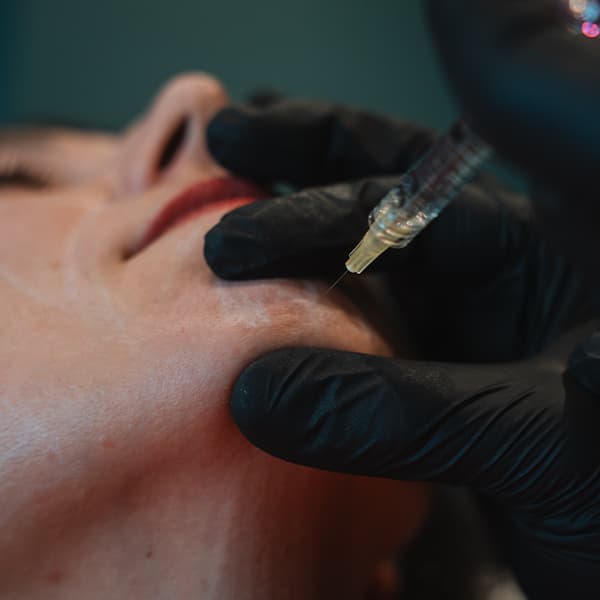 chin-filler-treatment