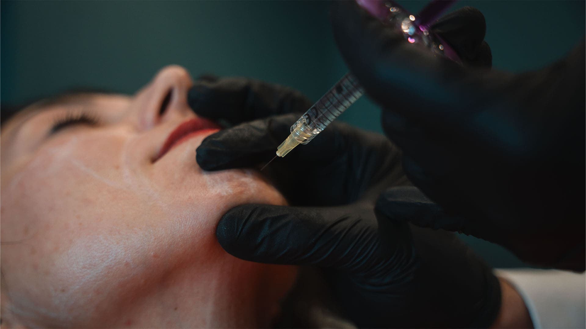 Woman receiving skin rejuvenation treatment at Cannelle Skin Clinic, professional skincare clinic in.