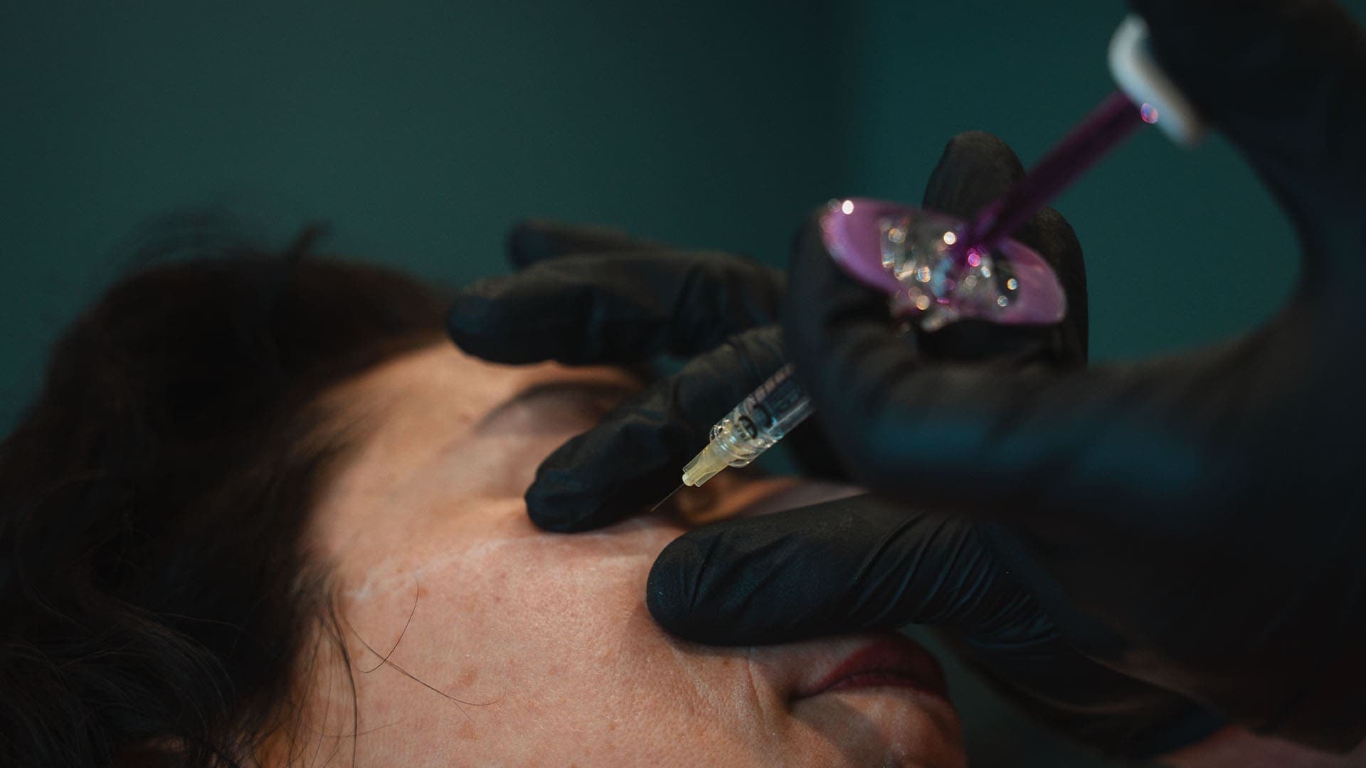 Close-up of a dermal filler injection being administered at Cannelle Skin Clinic.