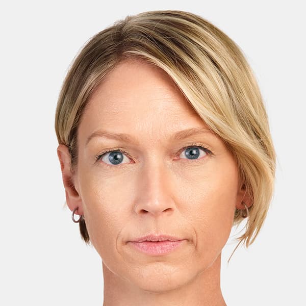 jackie-after-6months