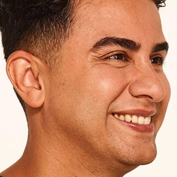 Close-up of a smiling man with clear, healthy skin and well-groomed appearance.