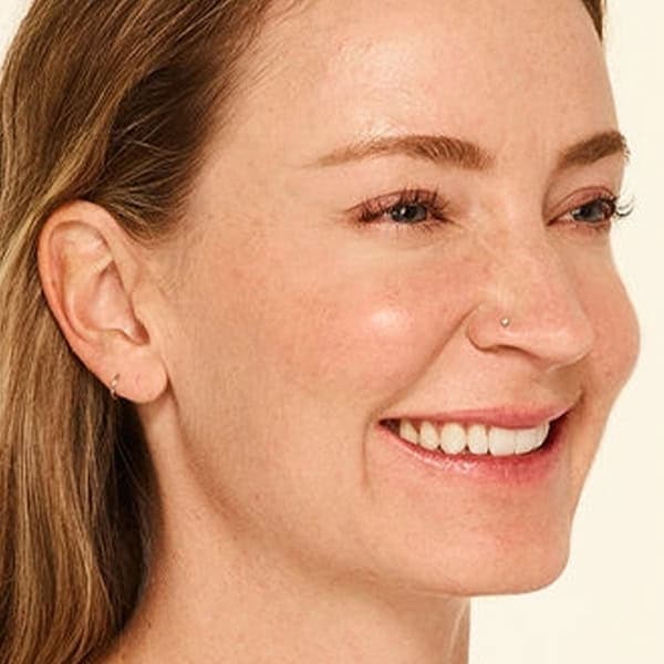 Woman with clear, glowing skin after facial treatment at Cannelle Skin Clinic.