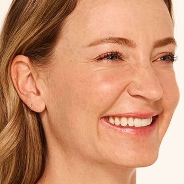 Close-up of a smiling woman with clear skin, promoting skincare treatments at Cannelle Skin Clinic.