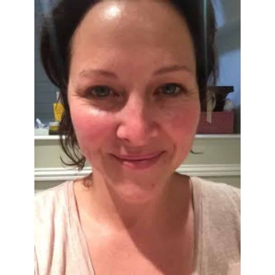 Woman with clear skin smiling after facial treatment at Cannelle Skin Clinic, London.