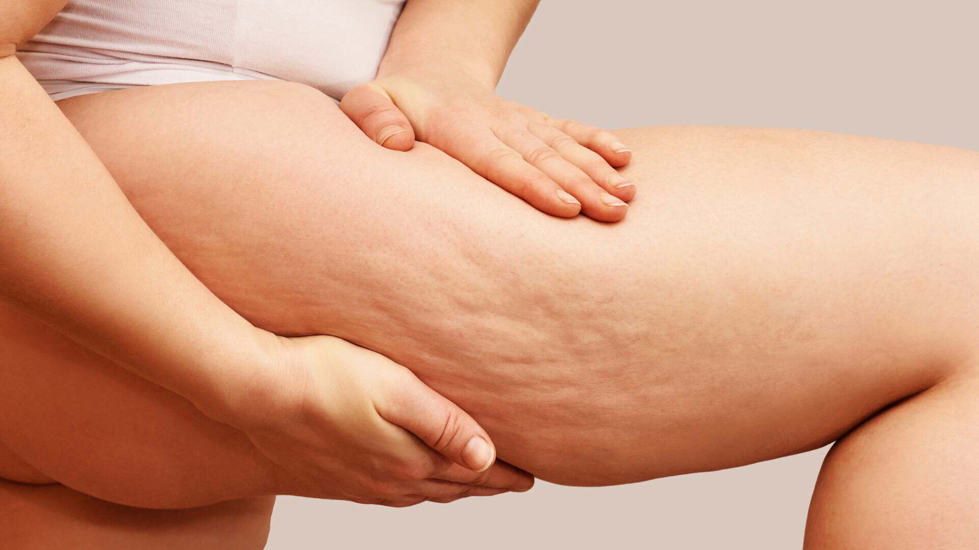 Woman's thigh showing cellulite, close-up at Cannelle Skin Clinic.