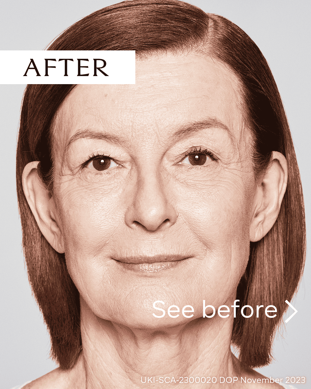 Rejuvenated woman with improved skin texture and youthful appearance after skincare treatment.