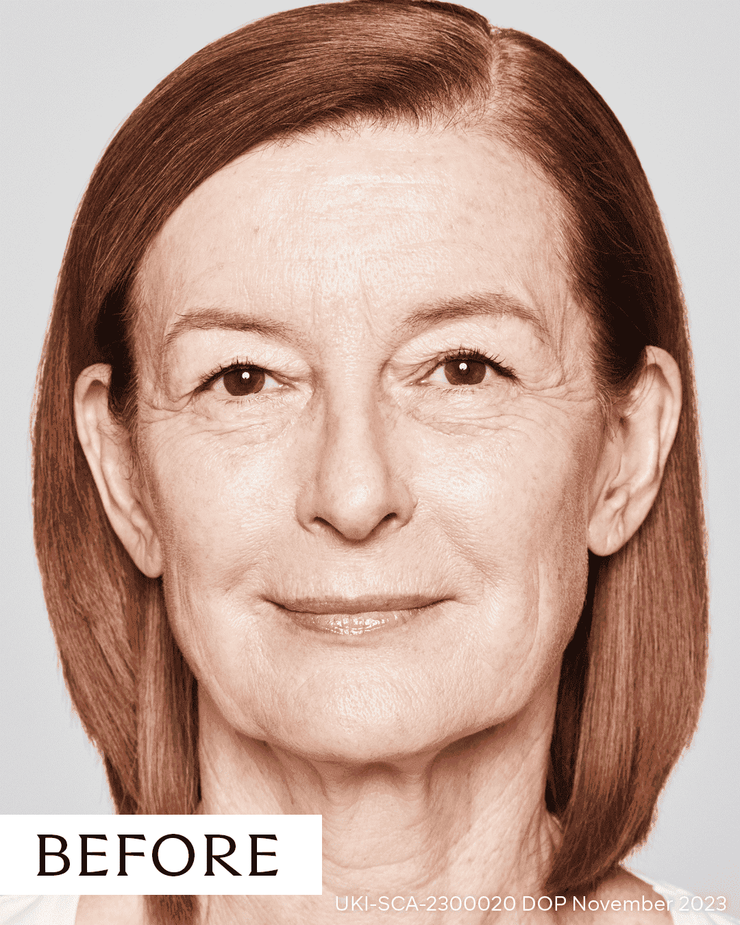 Before facial rejuvenation treatment at Cannelle Skin Clinic, showcasing mature skin and natural app.