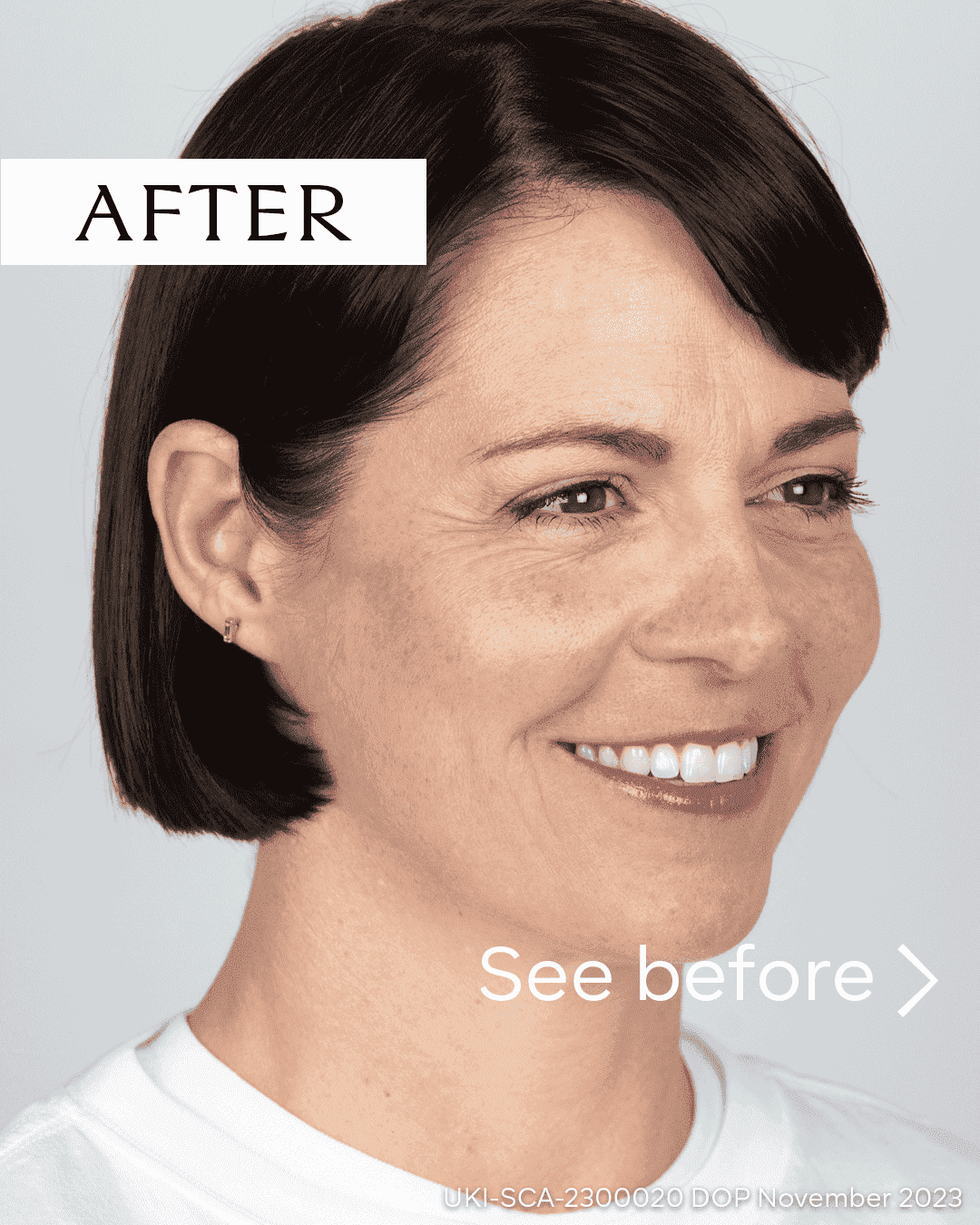 Woman with clear, smooth skin after facial treatment at Cannelle Skin Clinic.