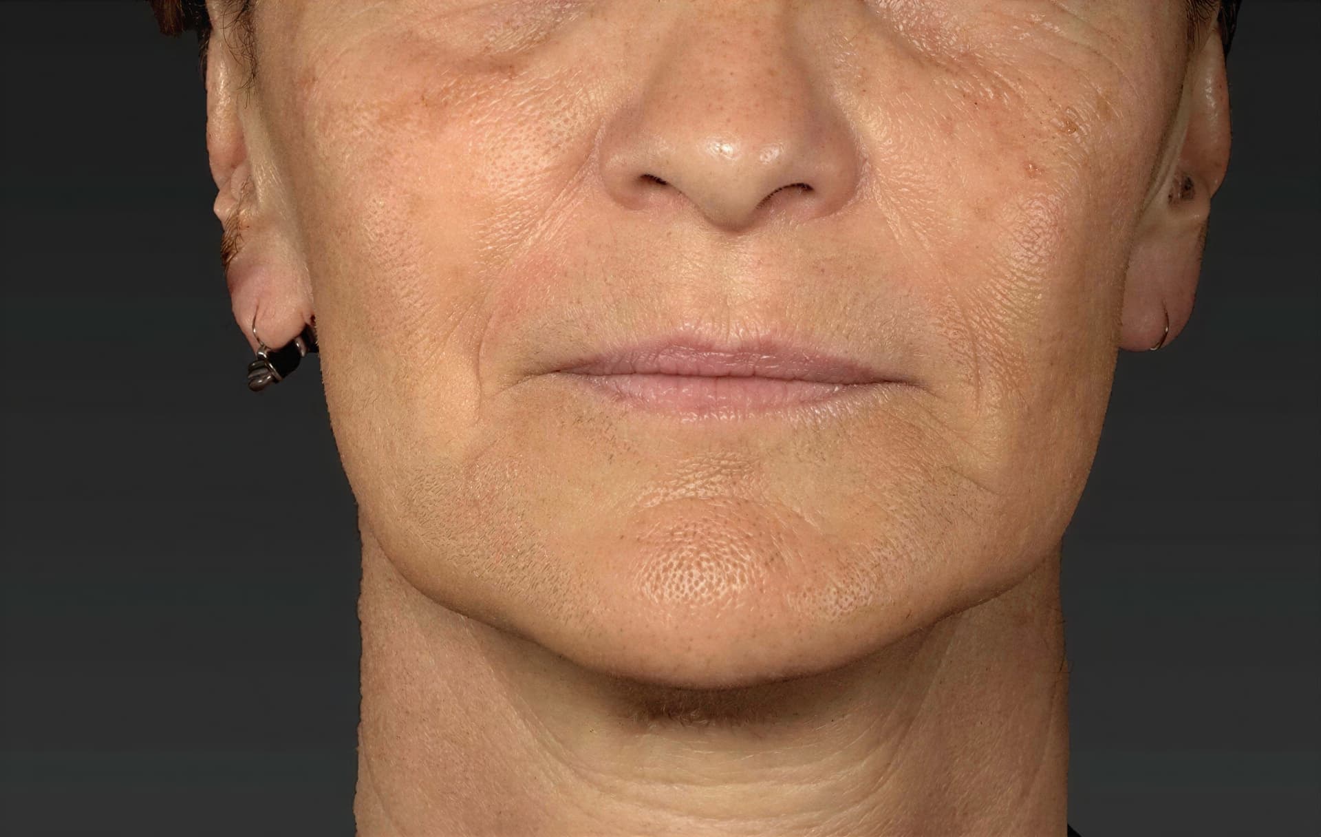 Close-up of mature woman's face showing skin rejuvenation results at Cannelle Skin Clinic.