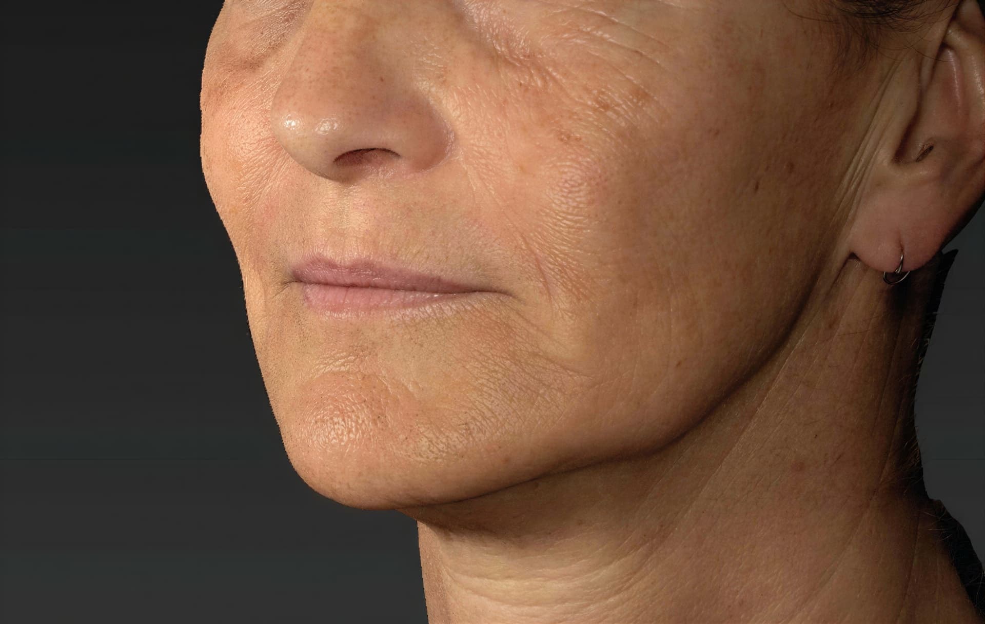 Close-up of mature woman's face showing skin texture and signs of aging.