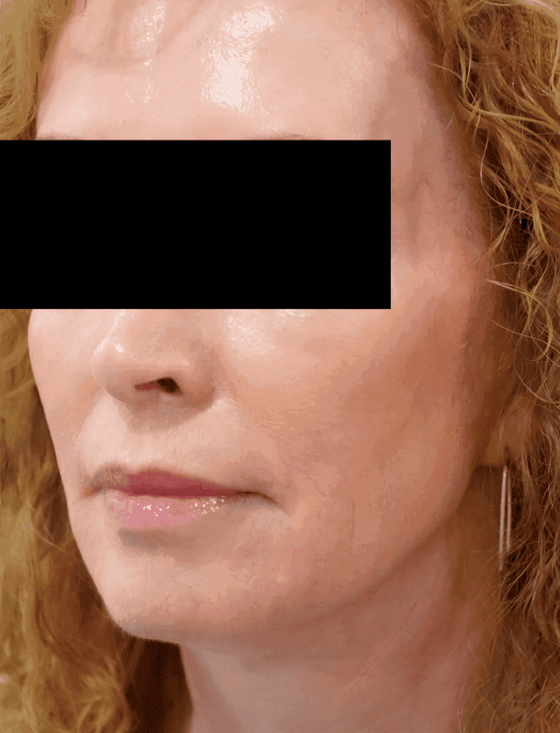 Rejuvenating facial skin treatment performed at Cannelle Skin Clinic, focusing on anti-ageing and sk.