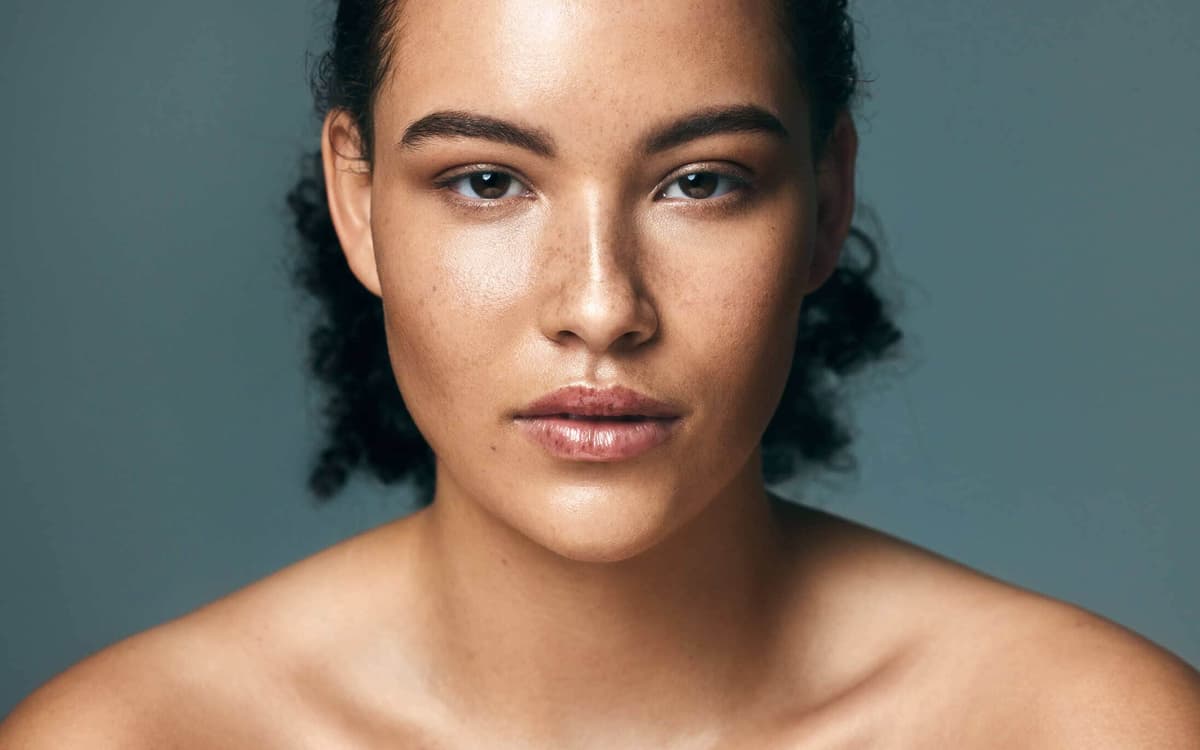 Pigmentation Treatment in London
