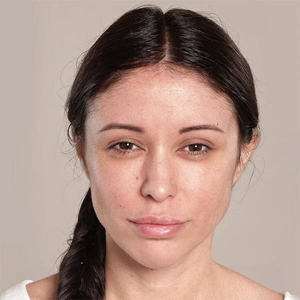 Woman with clear, smooth skin after facial treatment at Cannelle Skin Clinic.