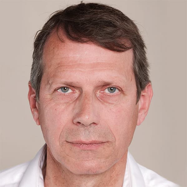 frederic-before-filler