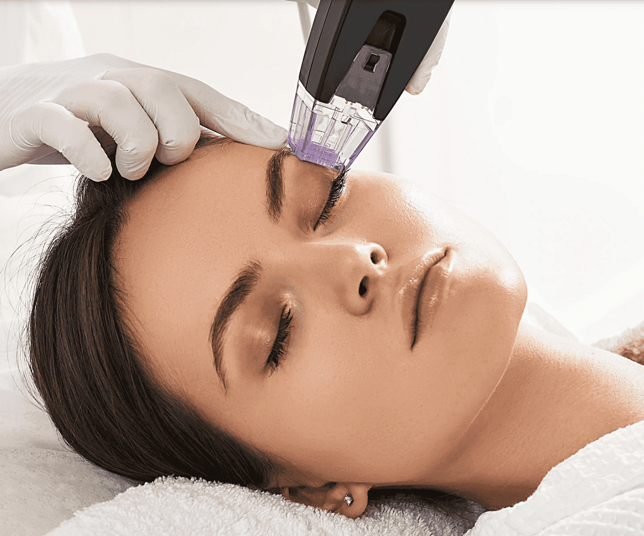 Woman receiving skin rejuvenation treatment with a micro-needling device at Cannelle Skin Clinic.