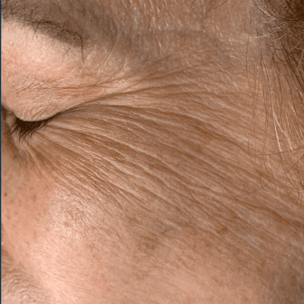 Close-up of fine lines and wrinkles on mature woman's skin, skin care and anti-ageing treatment focu.