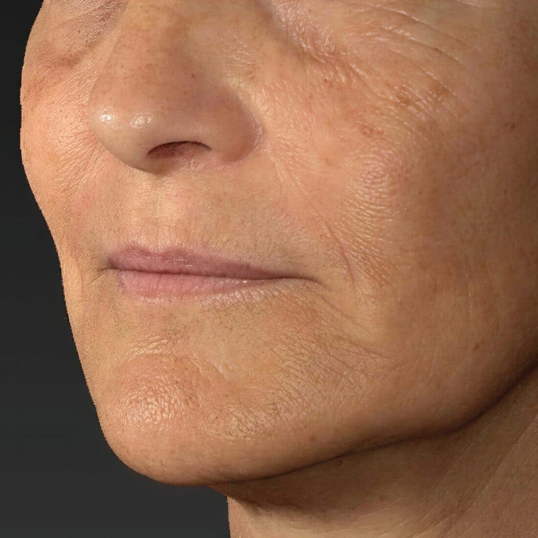 Close-up of mature woman's face showing skin texture and signs of aging.