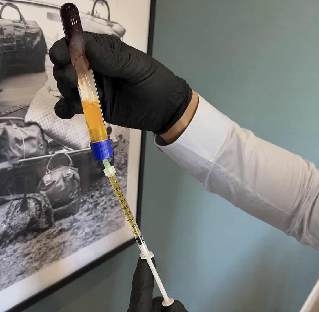 Medical professional administering skin treatment with syringe at Cannelle Skin Clinic.