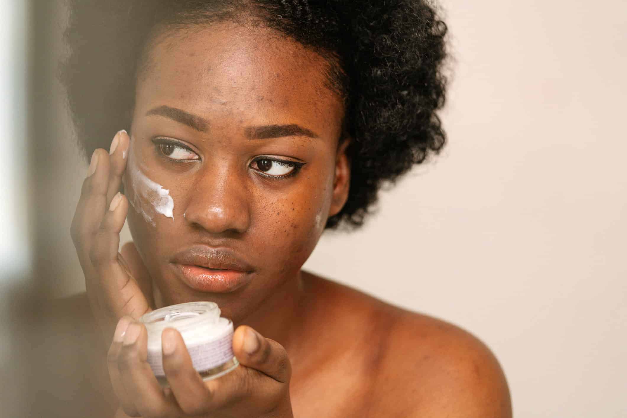 Can You Treat Acne Scars at Home?