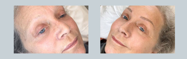 semi permanent makeup at cannelle medispa, eyeliner and eyebrows