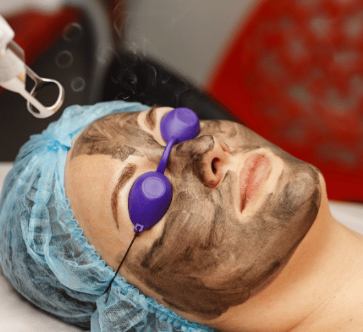 woman having carbon facial