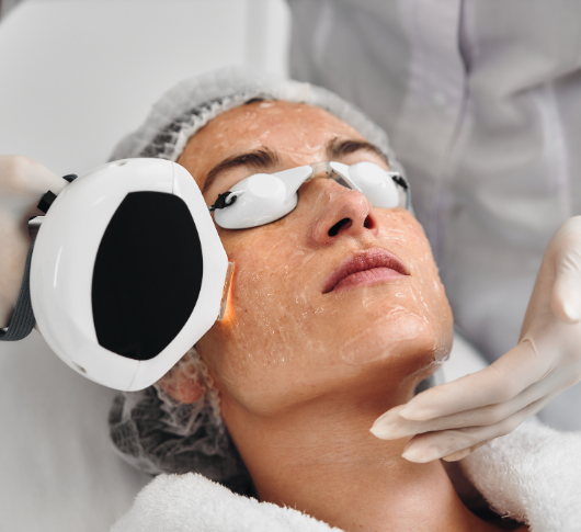 Lumecca treatment done on the face