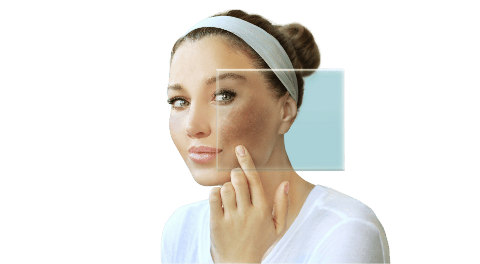 Sun Damage Main image