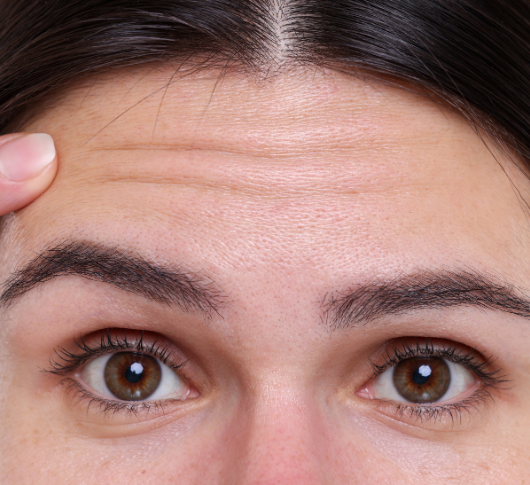 Woman Showing Wrinkles