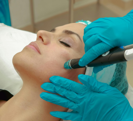 Woman’s face treated with Exosomes aesthetic treatment